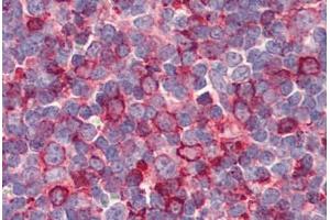 Tonsil, Human: Formalin-Fixed, Paraffin-Embedded (FFPE) (GPR26 antibody  (Internal Region))