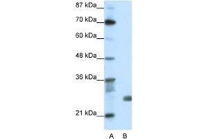 WB Suggested Anti-SAP30 Antibody Titration:  1. (SAP30 antibody  (N-Term))