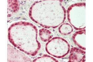 Human Thyroid: Formalin-Fixed, Paraffin-Embedded (FFPE) (SF3B1 antibody  (AA 100-150))