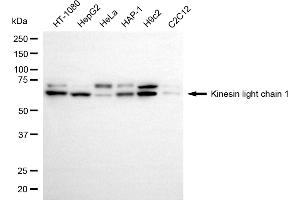 Western blotting analysis using kinesin light chain 1 antibody (ABIN7799210). (Recombinant KLC1 antibody)
