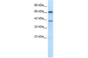 WB Suggested Anti-PRDM14 Antibody Titration: 1. (PRDM14 antibody  (Middle Region))