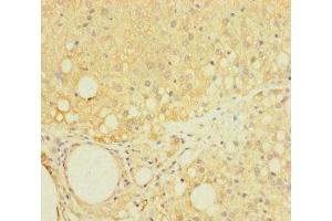 Immunohistochemistry of paraffin-embedded human adrenal gland tissue using ABIN7158796 at dilution of 1:100 (LAPTM5 antibody  (AA 205-262))