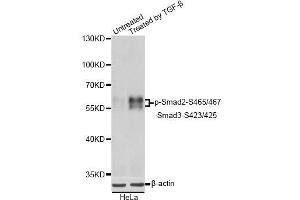 Western blot analysis of extracts of HeLa cells, using Phospho-Smad2-S465/467/-Smad3-S423/425 antibody. (SMAD2 / SMAD3 (pSer423), (pSer425) antibody)