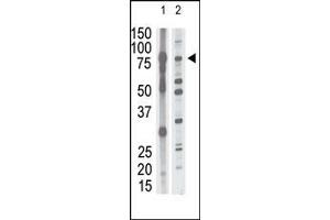 The anti-P15 N-term Antibody (ABIN390139 and ABIN2840643) is used in Western blot to detect P15 in mouse brain tissue lysate (lane 1) and HL60 cell lysate (lane 2) lysate. (MMP15 antibody  (N-Term))