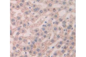 IHC-P analysis of Rat Tissue, with DAB staining. (Thymic Stromal Lymphopoietin antibody  (AA 75-196))