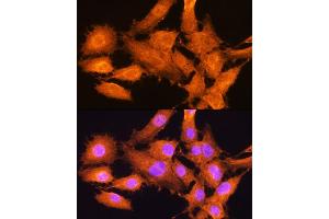 Immunofluorescence analysis of C6 cells using AIRE Rabbit pAb (ABIN3022514, ABIN3022515, ABIN3022516 and ABIN6218869) at dilution of 1:100.