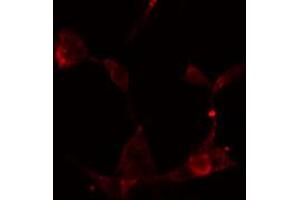 ABIN6274886 staining HeLa cells by IF/ICC. (ABCF1 antibody  (C-Term))