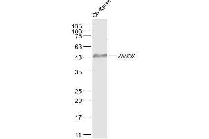 Mouse cerebrum lysates probed with WWOX Polyclonal Antibody, Unconjugated  at 1:500 dilution and 4˚C overnight incubation. (WWOX antibody  (AA 5-100))
