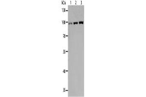 Western Blotting (WB) image for anti-Toll-Like Receptor 3 (TLR3) antibody (ABIN2427612) (TLR3 antibody)