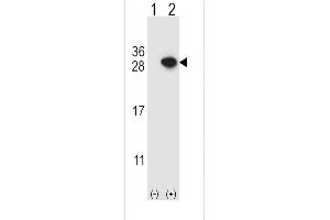 Western blot analysis of ARHGDIA using rabbit polyclonal ARHGDIA Antibody using 293 cell lysates (2 ug/lane) either nontransfected (Lane 1) or transiently transfected (Lane 2) with the ARHGDIA gene. (ARHGDIA antibody  (C-Term))