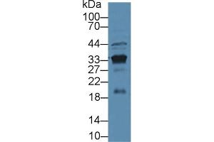 Detection of PSA in Mouse Kidney lysate using Polyclonal Antibody to Prostate Specific Antigen (PSA) (Prostate Specific Antigen antibody  (AA 39-261))
