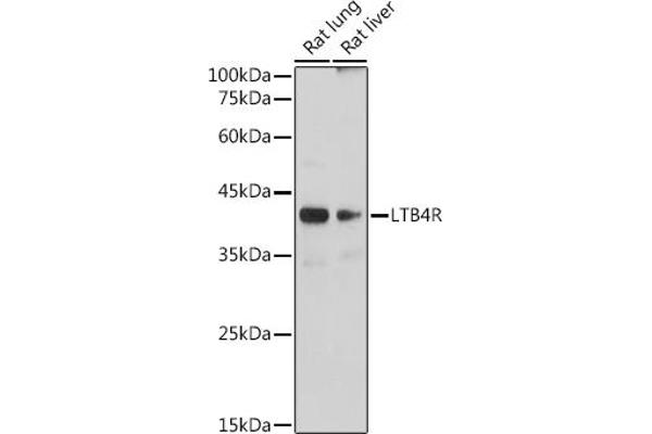 Leukotriene B4 Receptor/BLT anticorps
