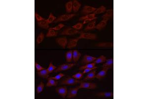 Immunofluorescence analysis of NIH/3T3 cells using Bcl-2 Mouse mAb (ABIN7265809) at dilution of 1:100 (40x lens). (Bcl-2 antibody)