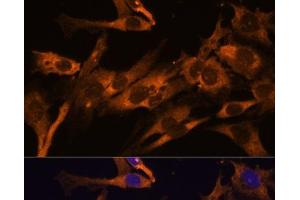 Immunofluorescence analysis of C6 cells using RPL36AL Polyclonal Antibody at dilution of 1:100 (40x lens). (RPL36AL antibody)