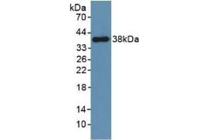 Detection of Recombinant PDGFRb, Mouse using Polyclonal Antibody to Platelet Derived Growth Factor Receptor Beta (PDGFRb) (PDGFRB antibody  (AA 337-583))