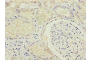 Immunohistochemistry of paraffin-embedded human kidney tissue using ABIN7159124 at dilution of 1:100 (MED22 antibody  (AA 2-140))