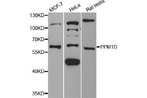 Western blot analysis of extracts of various cell lines, using PPM1D antibody (ABIN5973651) at 1/1000 dilution. (PPM1D antibody)