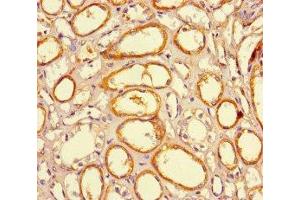 Immunohistochemistry of paraffin-embedded human kidney tissue using ABIN7165672 at dilution of 1:100 (JARID2 antibody  (AA 1-159))