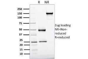 SDS-PAGE (SDS) image for anti-Protein-tyrosine Phosphatase 1C (PTPN6) antibody (ABIN6939660)