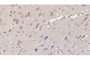 Detection of IL29 in Human Cerebrum Tissue using Monoclonal Antibody to Interleukin 29 (IL29) (IL29 antibody  (AA 20-200))