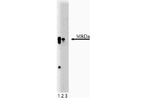 Western blot analysis of AP50 on a rat cerebrum lysate. (AP2M1 antibody  (AA 110-230))