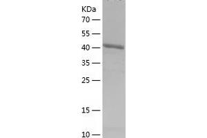 Western Blotting (WB) image for Density-Regulated Protein (DENR) (AA 1-198) protein (His-IF2DI Tag) (ABIN7283987) (Density Regulated Protein Protein (AA 1-198) (His-IF2DI Tag))