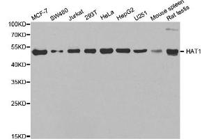 Western Blotting (WB) image for anti-Histone Acetyltransferase 1 (HAT1) antibody (ABIN1882320) (HAT1 antibody)