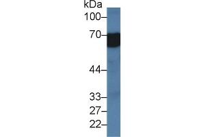 Detection of MAOA in Rat Serum using Polyclonal Antibody to Monoamine Oxidase A (MAOA)