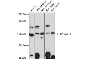Western blot analysis of extracts of various cell lines, using IL1R antibody (ABIN1680448, ABIN3017765, ABIN3017766 and ABIN6220239) at 1:3000 dilution. (IL1RAPL1 antibody  (AA 130-210))