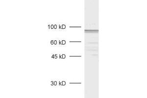 dilution: 1 : 1000, sample: rat retina extract (MPP5 antibody  (AA 2-244))