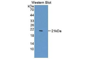 Detection of Recombinant PTPN13, Mouse using Polyclonal Antibody to Protein Tyrosine Phosphatase, Non Receptor Type 13 (PTPN13) (PTPN13 antibody  (AA 1-161))