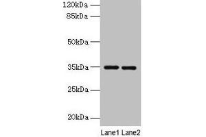 Western blot All lanes: Thpo antibody at 4 μg/mL Lane 1: Mouse liver tissue Lane 2: 293T whole cell lysate Secondary Goat polyclonal to rabbit IgG at 1/10000 dilution Predicted band size: 35 kDa Observed band size: 35 kDa (Thrombopoietin antibody  (AA 22-194))