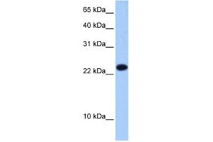EIF4E3 antibody used at 0. (EIF4E3 antibody  (Middle Region))