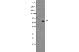 Western blot analysis of CLK3 expression in A431 whole cell lysate ,The lane on the left is treated with the antigen-specific peptide.