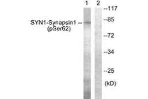 Western blot analysis of extracts from HeLa cells treated with Anisomycin 25ug/ml 30', using Synapsin1 (Phospho-Ser62) Antibody. (SYN1 antibody  (pSer62))