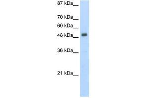 Desmin antibody used at 5 ug/ml to detect target protein. (Desmin antibody  (N-Term))