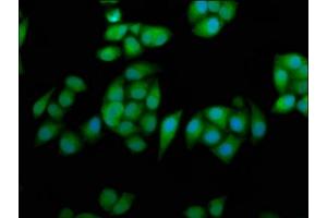 Immunofluorescence staining of Hela cells with ABIN7167824 at 1:233, counter-stained with DAPI. (RPE65 antibody  (AA 348-484))