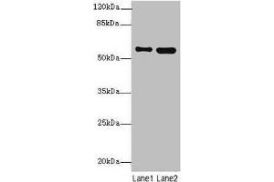 Western blot All lanes: STAM2 antibody at 4. (STAM2 antibody  (AA 376-525))