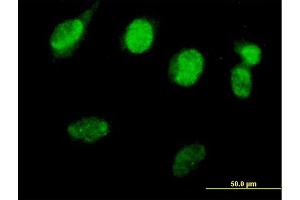 Immunofluorescence of purified MaxPab antibody to RAD51L3 on HeLa cell.