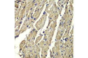 Immunohistochemistry of paraffin-embedded mouse heart using FXN antibody (ABIN5970875) at dilution of 1/100 (40x lens). (Frataxin antibody)