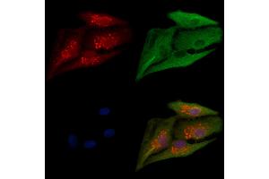 ABIN6264148 and ABIN6279651 staining  cells by IF/ICC. (PEX12 antibody  (Internal Region))
