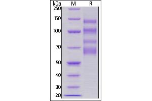 Human ITGA4&ITGB7 Heterodimer Protein, His Tag&Tag Free on  under reducing (R) condition. (ITGA4/ITGB7 Protein (AA 34-977) (His tag))