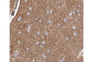 ABIN6267254 at 1/200 staining human brain tissue sections by IHC-P. (ABL1 antibody  (pTyr245))