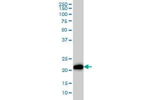 K-RAS antibody  (AA 16-125)