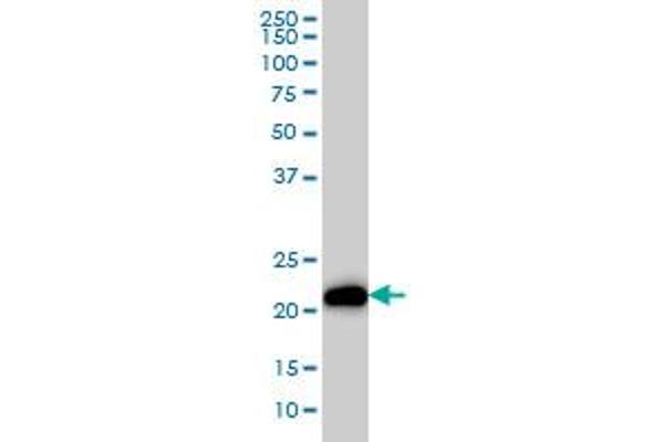 K-RAS antibody  (AA 16-125)
