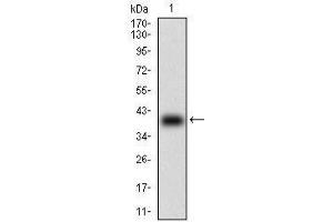 Western Blotting (WB) image for anti-beta-2-Microglobulin (B2M) (AA 21-100) antibody (ABIN1724930)