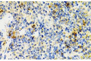 Immunohistochemistry of paraffin-embedded Mouse spleen using SH2B1 Polyclonal Antibody at dilution of 1:100 (40x lens).