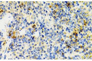 Immunohistochemistry of paraffin-embedded Mouse spleen using SH2B1 Polyclonal Antibody at dilution of 1:100 (40x lens). (SH2B1 antibody)