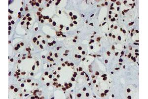 Immunohistochemical staining of paraffin-embedded Human Kidney tissue using anti-NONO mouse monoclonal antibody.