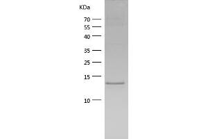 Chemokine (C-X-C Motif) Ligand 10 (CXCL10) (AA 22-98) (Active) protein (His tag)